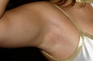 0559 - 320 x 213 [7KB]
�L�����M�����@�����D�q�̃��L