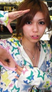 1566 - 181 x 320 [14KB]
��V�������b�e�̃��L�ш����@���L�уt�F�`�ߑ�